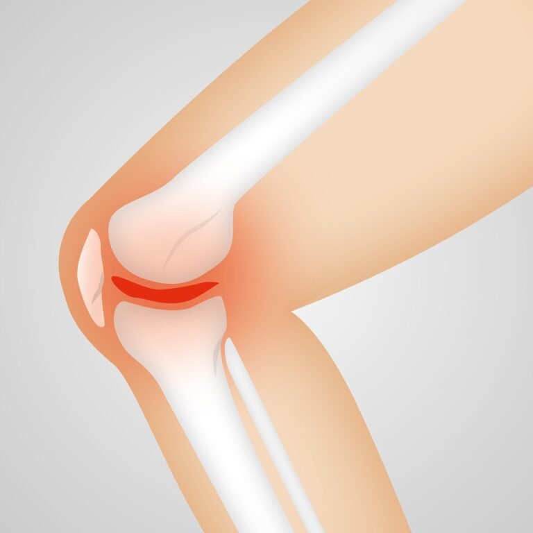 गठिया (आर्थराइटिस) के घरेलू उपाय – Home Remedies for Arthritis in Hindi